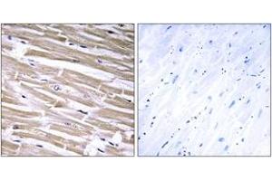 Immunohistochemistry analysis of paraffin-embedded human heart tissue, using B3GALT2 Antibody. (B3GALT2 抗体  (AA 373-422))