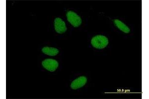 Immunofluorescence of purified MaxPab antibody to ZNF43 on HeLa cell. (ZNF43 抗体  (AA 1-803))
