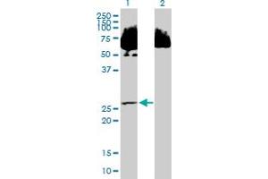 Western Blot analysis of SDR39U1 expression in transfected 293T cell line by SDR39U1 MaxPab polyclonal antibody. (SDR39U1 抗体  (AA 1-293))