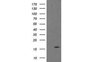 Western Blotting (WB) image for anti-Tumor Protein D52-Like 3 (TPD52L3) antibody (ABIN1501479) (TPD52L3 抗体)