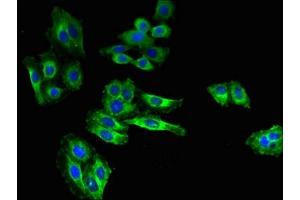 Immunofluorescence (IF) image for anti-Solute Carrier Family 6 (Neutral Amino Acid Transporter), Member 15 (SLC6A15) (AA 357-452) antibody (ABIN7169984)