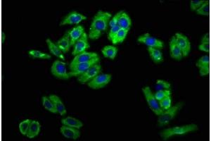 Immunofluorescence staining of HepG2 cells with ABIN7161183 at 1:100, counter-stained with DAPI. (UNC5B 抗体  (AA 404-517))