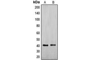 Western blot analysis of ENDOGL1 expression in Jurkat (A), HepG2 (B) whole cell lysates. (EXOG 抗体  (Center))