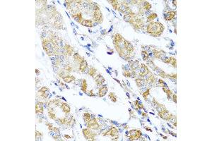 Immunohistochemistry of paraffin-embedded human gastric using DARS2 antibody at dilution of 1:100 (x40 lens). (DARS2 抗体)