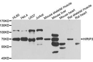 Western blot analysis of extracts of various cell lines, using HIRIP3 antibody (ABIN5974221) at 1/1000 dilution. (HIRIP3 抗体)