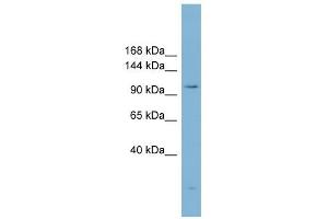 ACLY antibody used at 1 ug/ml to detect target protein. (ACLY 抗体  (Middle Region))