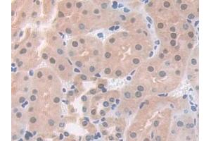 Detection of PDXK in Mouse Kidney Tissue using Polyclonal Antibody to Pyridoxal Kinase (PDXK) (PDXK 抗体  (AA 29-285))