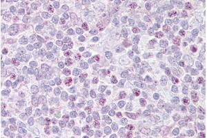 Immunohistochemistry with Thymus tissue at an antibody concentration of 5µg/ml using anti-EBF1 antibody (ARP39578_P050) (EBF1 抗体)