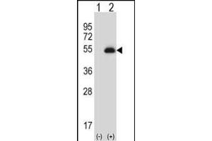 Western blot analysis of X6 (arrow) using rabbit polyclonal X6 Antibody (ABIN656844 and ABIN2846051). (PAX6 抗体)