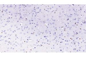 Detection of PCSK9 in Rat Cerebrum Tissue using Monoclonal Antibody to Proprotein Convertase Subtilisin/Kexin Type 9 (PCSK9)