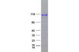 Western Blotting (WB) image for Dipeptidyl-Peptidase 6 (DPP6) (Transcript Variant 1) protein (Myc-DYKDDDDK Tag) (ABIN2719726)