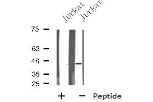Western blot analysis of extracts from Jurkat cells, using EDG7 antibody. (LPAR3 抗体  (Internal Region))