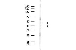 anti-Cell Adhesion Molecule 2 (CADM2) (Internal Region) antibody
