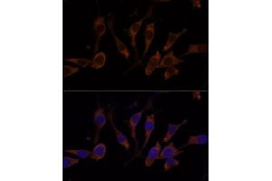 Immunofluorescence (IF) image for anti-Ribosomal Protein L32 (RPL32) (AA 1-135) antibody (ABIN6147138)