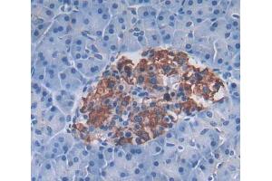 Used in DAB staining on fromalin fixed paraffin- embedded pancreas tissue (PLA2G12A 抗体  (AA 23-189))