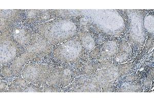 IHC analysis of EEF2/Elongation factor 2 using anti-EEF2/Elongation factor 2 antibody (ABIN7603142).