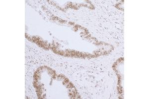 anti-LAP2 beta/tmpo (AA 225-275) antibody