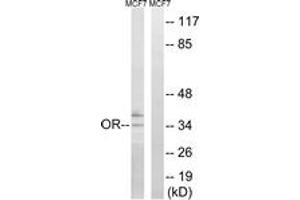 Western blot analysis of extracts from MCF-7 cells, using OR51H1 Antibody. (OR51H1 抗体  (AA 201-250))