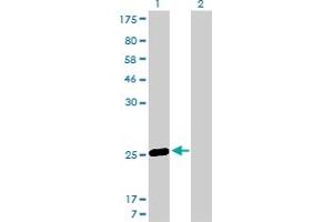 Western Blot analysis of MS4A7 expression in transfected 293T cell line by MS4A7 monoclonal antibody (M06), clone 2D3. (MS4A7 抗体  (AA 1-240))