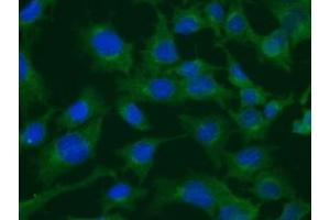 Immunofluorescence (IF) image for anti-Clathrin Heavy Chain (CLTC) (N-Term) antibody (ABIN6254150) (Clathrin Heavy Chain (CLTC) (N-Term) 抗体)