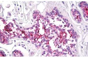 Image no. 2 for anti-Mucin 1 (MUC1) antibody (ABIN1502278) (MUC1 抗体)