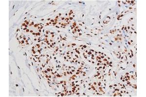 Immunohistochemistry (IHC) image for anti-Mast/stem Cell Growth Factor Receptor (KIT) (pTyr721) antibody (ABIN6256004)