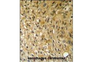Immunohistochemistry (Paraffin-embedded Sections) (IHC (p)) image for anti-SAM Domain, SH3 Domain and Nuclear Localization Signals, 1 (SAMSN1) (AA 255-283) antibody (ABIN652058)