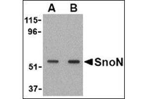 Western blot analysis of SnoN in A431 cell lysate with this product at (A) 0.