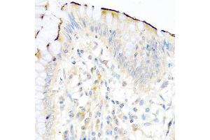 Immunohistochemistry of paraffin-embedded human colon using NRG4 antibody at dilution of 1:100 (40x lens). (Neuregulin 4 抗体)