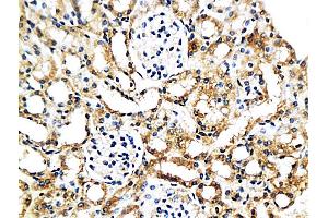 Formalin-fixed and paraffin embedded mouse kidney labeled with Anti-MCP-2 Polyclonal Antibody, Unconjugated (ABIN676283) at 1:200 followed by conjugation to the secondary antibody and DAB staining