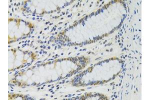Immunohistochemistry of paraffin-embedded human colon using PPP4C antibody (ABIN5971135) at dilution of 1/100 (40x lens). (PPP4C 抗体)