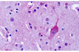 Anti-MGLUR4 antibody IHC staining of human brain, cortex, neurons. (Metabotropic Glutamate Receptor 4 抗体  (C-Term))