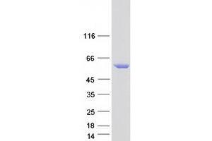 Western Blotting (WB) image for serine/threonine Kinase 32C (STK32C) protein (Myc-DYKDDDDK Tag) (ABIN2732874)