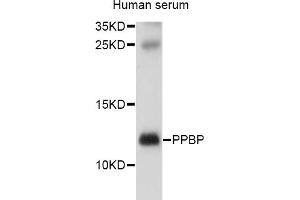 Western blot analysis of extracts of human serum, using PPBP antibody (ABIN1874208) at 1:1000 dilution. (CXCL7 抗体)