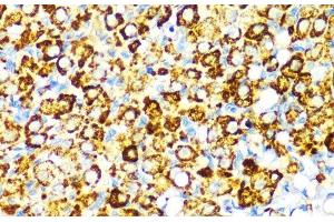 Immunohistochemistry of paraffin-embedded Rat ovary using PBEF / NAMPT Polyclonal Antibody at dilution of 1:100 (40x lens). (NAMPT 抗体)