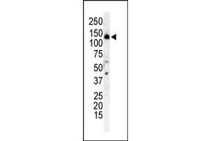 Western Blotting (WB) image for anti-Phosphoinositide 3-kinase Regulatory Subunit 4 (PIK3R4) (N-Term) antibody (ABIN360462) (PIK3R4 抗体  (N-Term))