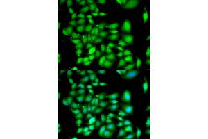 Immunofluorescence analysis of A549 cells using TREX1 antibody (ABIN5974106). (TREX1 抗体)