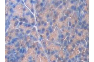 Immunohistochemistry (IHC) image for anti-Coagulation Factor V (F5) (AA 364-611) antibody (ABIN7438925)