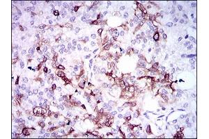 Image no. 3 for anti-Secreted phosphoprotein 1 (SPP1) antibody (ABIN1491004)