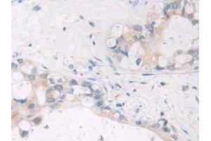 Immunohistochemistry (IHC) image for anti-Sirtuin 4 (SIRT4) (AA 28-314) antibody (ABIN7435928)