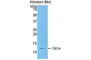 Western blot analysis of recombinant Human S100A5. (S100A5 抗体  (AA 1-92))