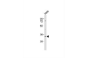 Anti-CD158g Antibody at 1:1000 dilution + Hela whole cell lysates Lysates/proteins at 20 μg per lane. (KIR2DS5 抗体)