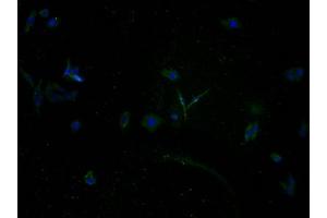 Immunofluorescence staining of HepG2 cells with ABIN7140161 at 1:100, counter-stained with DAPI. (TAS2R5 抗体  (AA 149-164))