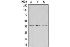 Western blot analysis of ZDHHC9 expression in HeLa (A), mouse kidney (B), rat brain (C) whole cell lysates. (ZDHHC9 抗体  (C-Term))