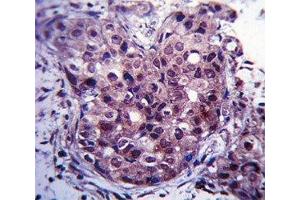 Immunohistochemistry (IHC) image for anti-Estrogen Receptor 1 (ESR1) (AA 246-273) antibody (ABIN3030871)