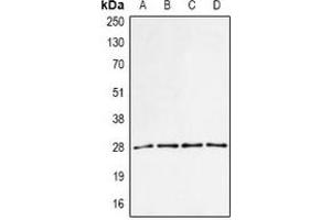 Western blot analysis of PA28 alpha expression in MCF7 (A), BT474 (B), mouse spleen (C), mouse liver (D) whole cell lysates. (PSME1 抗体)