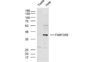 Lane 1: Mouse testis lysates, Lane 2: Hela lysates probed with FAM134B Polyclonal Antibody, Unconjugated  at 1:300 overnight at 4˚C. (FAM134B 抗体  (AA 210-310))