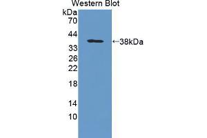 Western blot analysis of the recombinant protein. (PTPRG 抗体  (AA 848-1119))