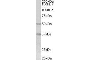 ABIN2562638 (0. (FOXA1 抗体  (C-Term))