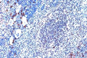 Immunohistochemistry of paraffin-embedded mouse spleen using JunD Rabbit mAb (ABIN7268051) at dilution of 1:100 (40x lens).